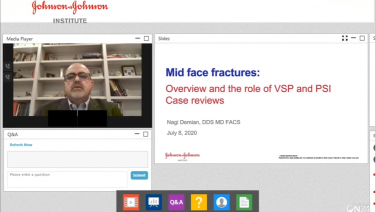 An image from the "TEC Talks: MidFace Truama Fractures with Nagi Demian, DDS, MD, FACS" video on the JnJInstitute.com website.