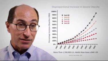 An image from the "Obesity Demographics in the USA Part 1 with David Kaplan, MD" video on JnJInstitute.com