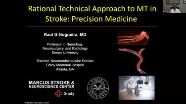 An image from the "Rational Technical Approach to Mechanical Thrombectomy in Stroke with Raul Nogueira, MD playlist on the JnJInstitute.com website.