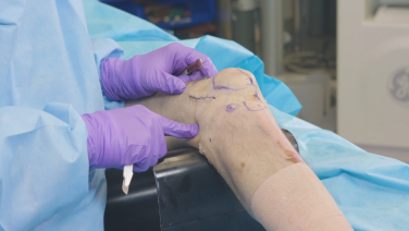 An image from the "RFN-Advanced Retrograde Femoral Nailing System (RFNA): Locking Attachment Washer, Parapatellar Approach with Matthew Graves, MD" video on the JnJInstitute.com website.