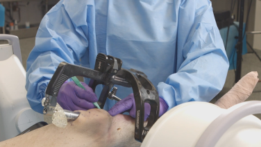 An image from the "TFN-ADVANCED Tibial Nailing System: Proximal Locking with Matthew Graves, MD" video on the JnJInstitute.com website.