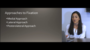 Am image from the "Ankle Fractures Classifications Approaches & Management with Megan Paulus, MD" video on the JnJInstitute.com website.