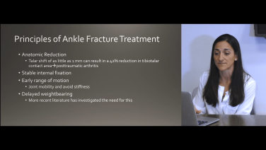 Am image from the "Ankle Fractures Operative / Surgical Indications & Diagnosis: Principles of Fracture Treatment with Megan Paulus, MD" video on the JnJInstitute.com website.