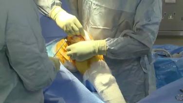 An image from the "ATTUNE® Rotating Platform: Exposure with Peter James, MD" video on the JnJInstitute.com website.
