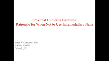 An image from the "Proximal Humerus Fractures: Why Not to Nail with Brian Vickaryous, MD" video on the JnJInstitute.com website.