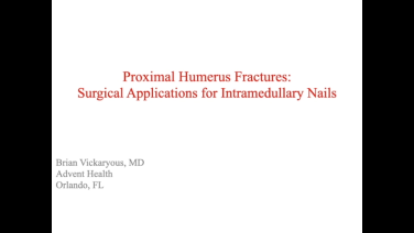 An image from the "Proximal Humerus Fractures: When to Use Intramedullary Nails with Brian Vickaryous, MD" video on the JnJInstitute.com website.