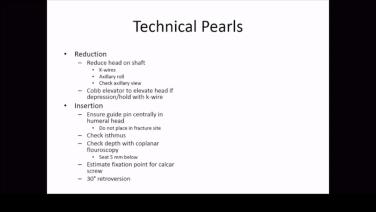 Thumbnail image of Proximal Humerus Fractures: Technical Pearls for MultiLoc Humeral Nails with Brian Vickaryous, MD