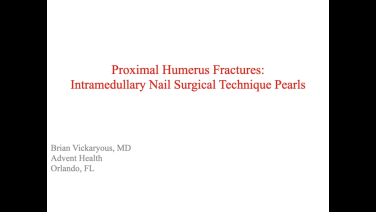 An image from the "Proximal Humerus Fractures: Technique for Intramedullary Nails with Brian Vickaryous, MD" video on the JnJInstitute.com website.