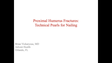An image from the "Proximal Humerus Fractures: Technical Pearls for MultiLoc Nails with Brian Vickaryous, MD" video on the JnJInstitute.com website.