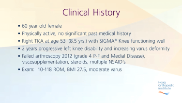 ATTUNE Knee System for Total Knee Arthroplasty: Preoperative Considerations with Robert Gorab, MD thumbnail