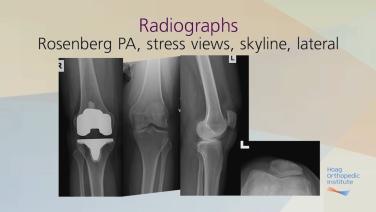 image of "Pre-Operative Evaluation with Robert Gorab, MD" video on jnjinstitute.com