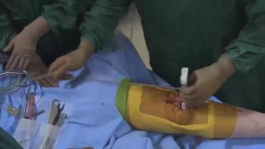 image of Balancing the Extension Gap with Robert Gorab, MD video on jnjinstitute.com