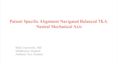 An image from the "Patient Specific Alignment: Tibia First Navigated Balance TKA Approach - Neutral Mechanical Axis" video on the JnJInstitute.com website.