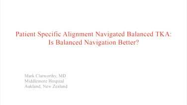 An image from the "Patient Specific Alignment: Tibia First Navigated Balance TKA Approach - Benefits of Balanced Approach" video on the JnJInstitute.com website.