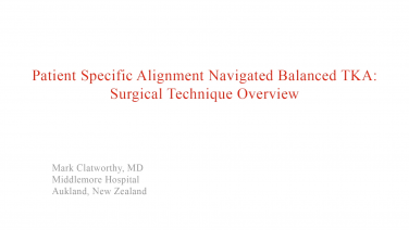 An image from the "Patient Specific Alignment: Tibia First Navigated Balance TKA Approach - Surgical Approach" video on the JnJInstitue.com website.