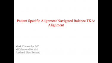 An image from the "Patient Specific Alignment: Tibia First Navigated Balance TKA Approach - Alignment
