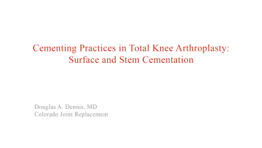 image of "Surface & Stem Cementation for Total Knee Arthroplasty with David Barrett, MD" video on jnjinstitute.com