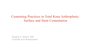An image from the "Surface & Stem Cementation for Total Knee Arthroplasty with David Barrett, MD" video on the JnJInstitute.com website.