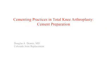 An image from the "Cement Preparation with David Barrett, MD" video on the JnJInstitute.com website.
