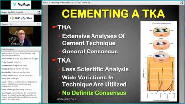 Cementing Practice in Total Knee Arthroplasty: Cement Technique with Douglas A. Dennis, MD thumbnail
