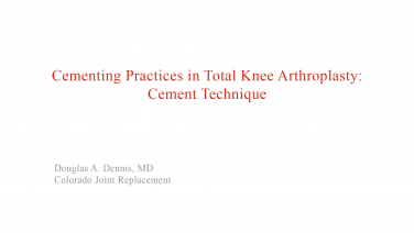 An image from the "Cement Technique with David Barrett, MD" video on the JnJInstitute.com website.