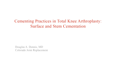 image from "Cementing Practices in Total Knee Arthroplasty: Surface & Stem" video on jnjinstitute.com