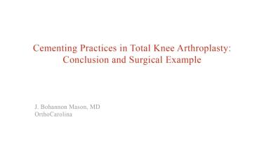 An image from the "Cementing Practices in Total Knee Arthroplasty: Case Examples" video on the JnJInstitute.com website.