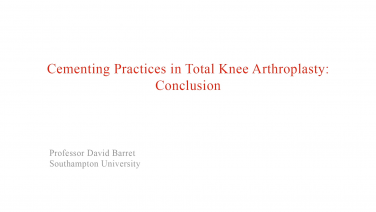 An image from the "Cementing Practices in Total Knee Arthroplasty: Summary and Review of Key Principles" video on the JnJInstitue.com website.