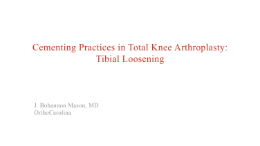 An image from the "Tibia Loosening with J. Bohannon Mason, MD" video on the JnJInstitute.com website.