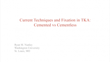 An image from the "Current Techniques & Fixation in Total Knee Arthroplasty: Background & Experience" video on the JnJInstitute.com website.