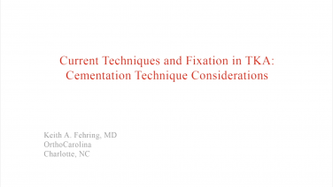 An image from the "Current Techniques & Fixation in Total Knee Cementation Techniques" video on the JnJInstitute.com website.