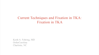 An image from the "Current Techniques & Fixation in Total Knee Arthroplasty: Evolution of Bone Cementing Techniques" video on the JnJInstitute.com website.