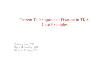 image of "Current Techniques & Fixation in Total Knee Arthroplasty: Case Examples" video on jnjinstitute.com