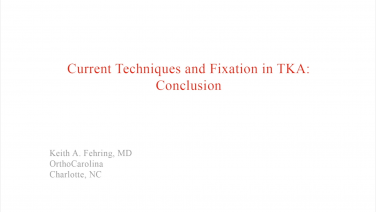 An image from the "Current Techniques & Fixation in Total Knee Arthroplasty: Cementing Pearls" video on the JnJInstitute.com website.
