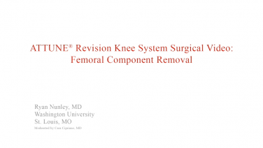 An image from the "ATTUNE Revision: Femoral Component Removal with Ryan Nunley, MD" video on the JnJInstitute.com website.