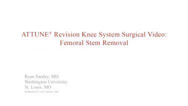 An image from the "ATTUNE Revision: Femoral Stem Removal with Ryan Nunley, MD" video on the JnJInstitue.com website.