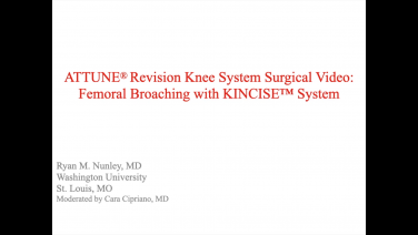 An image from the "ATTUNE Revision: Femoral Broaching with Ryan Nunley, MD" video on the JnJInstittue.com website.