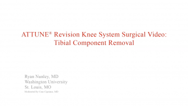 An image from the "ATTUNE Revision: Tibial Component Removal with Ryan Nunley, MD" video on the JnJInstitute.com website.