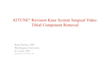 An image from the "ATTUNE Revision: Tibial Component Removal with Ryan Nunley, MD" video on the JnJInstitute.com website.