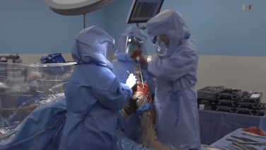 An image from the "ATTUNE Revision: Preparation for Tibia Stem with Ryan Nunley, MD" video on the JnJInstitute.com website.