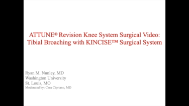 An image from the "ATTUNE Revision: Tibia Broaching with Ryan Nunley, MD" video on the JnJInstitute.com website.