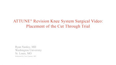 An image from the "ATTUNE Revision: Placement of Cut Through Trial with Ryan Nunley, MD" video on the JnJInstitute.com website.