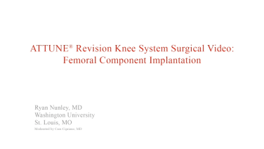 An image from the "ATTUNE Revision: Femoral Component Implantation with Ryan Nunley, MD" video on the JnJInstitute.com website.