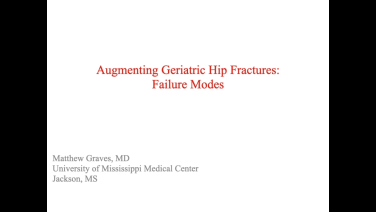 An image from the "Augmenting Geriatric Hip Fractures: Failure Modes with Matthew Graves, MD" video on the JnJInstitute.com website.
