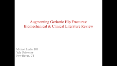 An image from the "Augmenting Geriatric Hip Fractures: Biomechanical & Clinical Literature Review for TRAUMACEM V+ with Michael Leslie, DO" video on the JnJInstitute.com website.