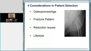 Augmenting Geriatric Fractures: Logical Indications through Case Examples with Michael Gardner, MD