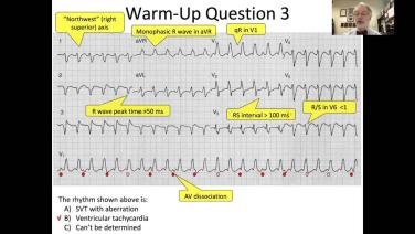 Wide Complex Tachycardias: Regular & Irregular with John Miller, MD Header Image