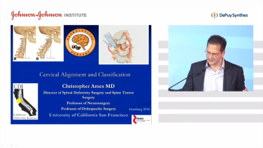 image of Cervical Alignment & Classification: Pelvic Incidence and Curvature with Christopher Ames, MD video on jnjinstitute.com