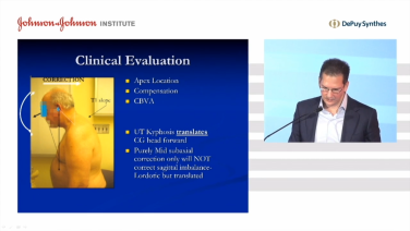 image of Cervical Alignment & Classification: Assessing the Patient with Christopher Ames, MD video on jnjinstitute.com