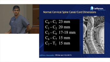 image of Cervical Spine Anatomy for Decompression: Dimensions, Diseases & Decision-Making with Srinivas Prasad, MD video on jnjinstitute.com